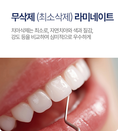 무삭제 (최소삭제) 라미네이트